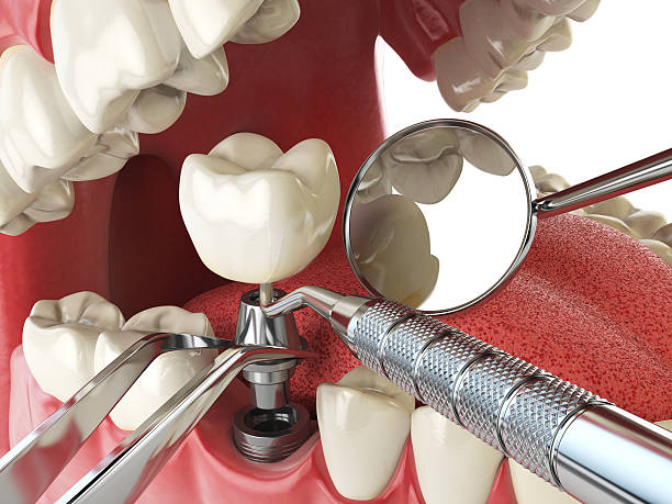 Best Urgent Tooth Repair  in Westwood, KY